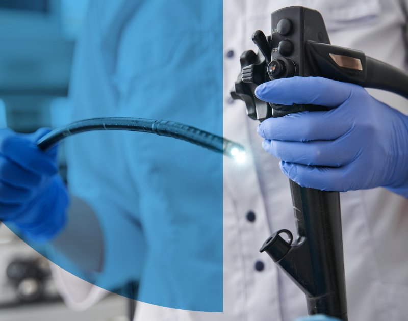 Qué es una endoscopia