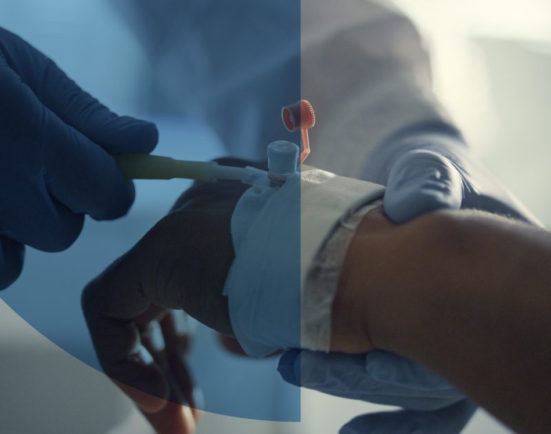 Sedación endovenosa